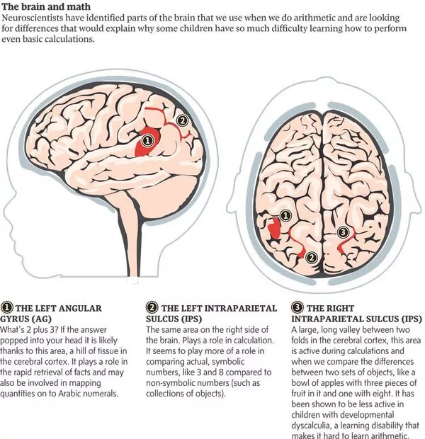 Keadaan neurologi Diskalkulia